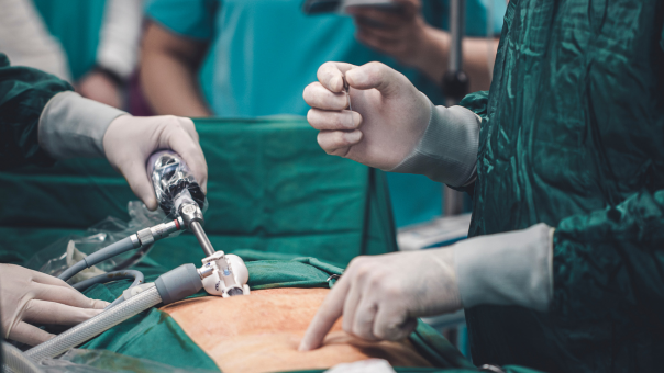 Laparoscopy for Gynecological Issues: A Game-Changer