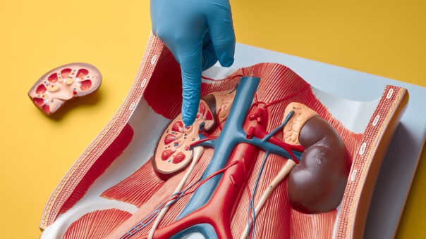 Preventing Kidney Stones: Diet and Lifestyle Tips from Dr. Dheeraj Shamsukha